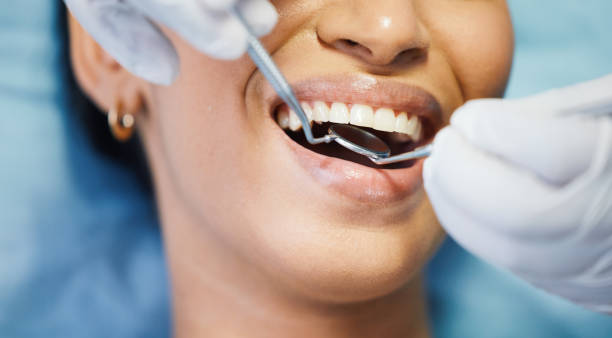 Best Emergency Dental Care for Broken or Chipped Teeth in Doa Ana, NM